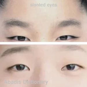 slanted eyes
